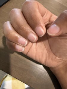 Amazon same product WEEM Hair Skin and Nails Gummies - Supports Healthy Hair - Vegan biotin Vitamins for Women & Men Supports Faster Hair Growth, Stronger Nails, Healthy Skin, Extra Strength photo review