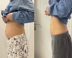 TCM Herbal Slimming Support Patch photo review