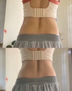 TCM Herbal Slimming Support Patch photo review