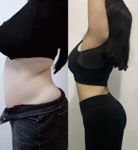 TCM Herbal Slimming Support Patch photo review