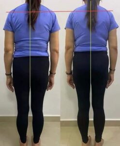 TCM Herbal Slimming Support Patch photo review