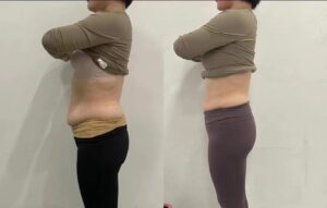 TCM Herbal Slimming Support Patch photo review